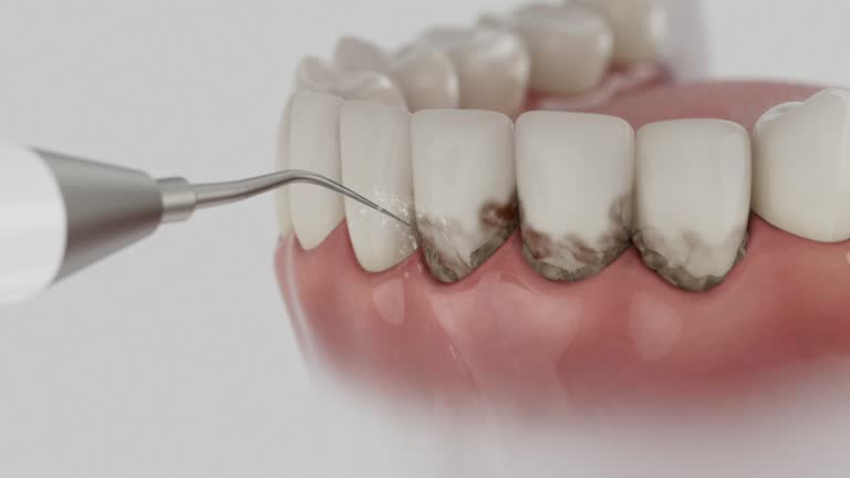 Trusted Tooth Extraction service in Linganore, MD - Dentist Open Now
